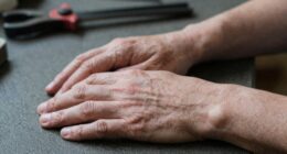 hand numbness from vibrations